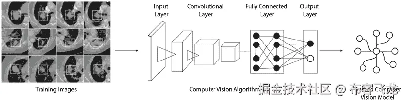 图 2.13 – 利用计算机视觉进行癌症检测