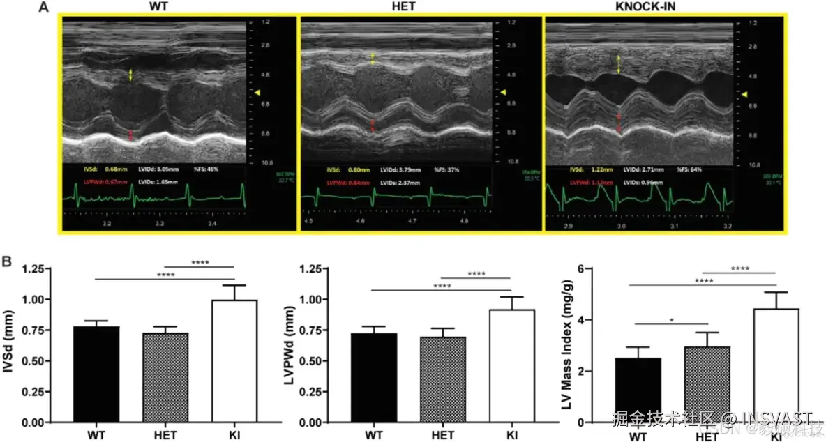 文献解读-CRISPR-Cas9 generated Pompe knock-in murine model exhibits early-onset hypertrophic cardiomyopa_基因生物_08