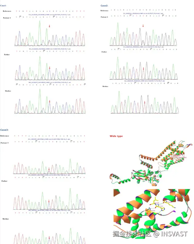 图3 3个病例家系突变情况