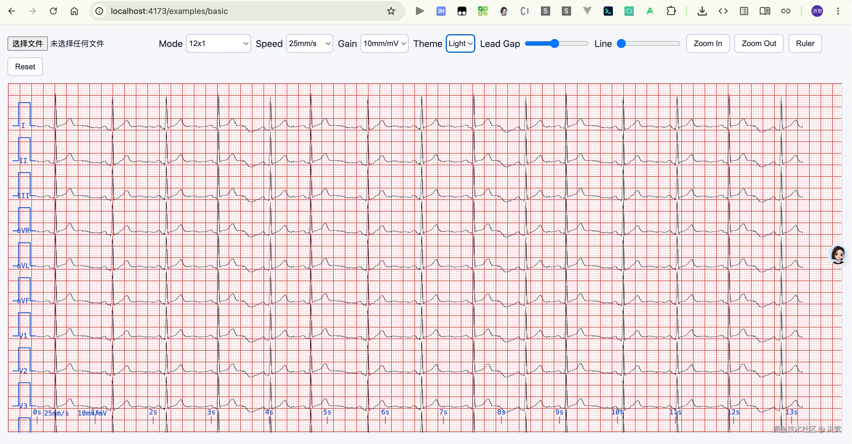 h5ECG light theme ECG paper effect