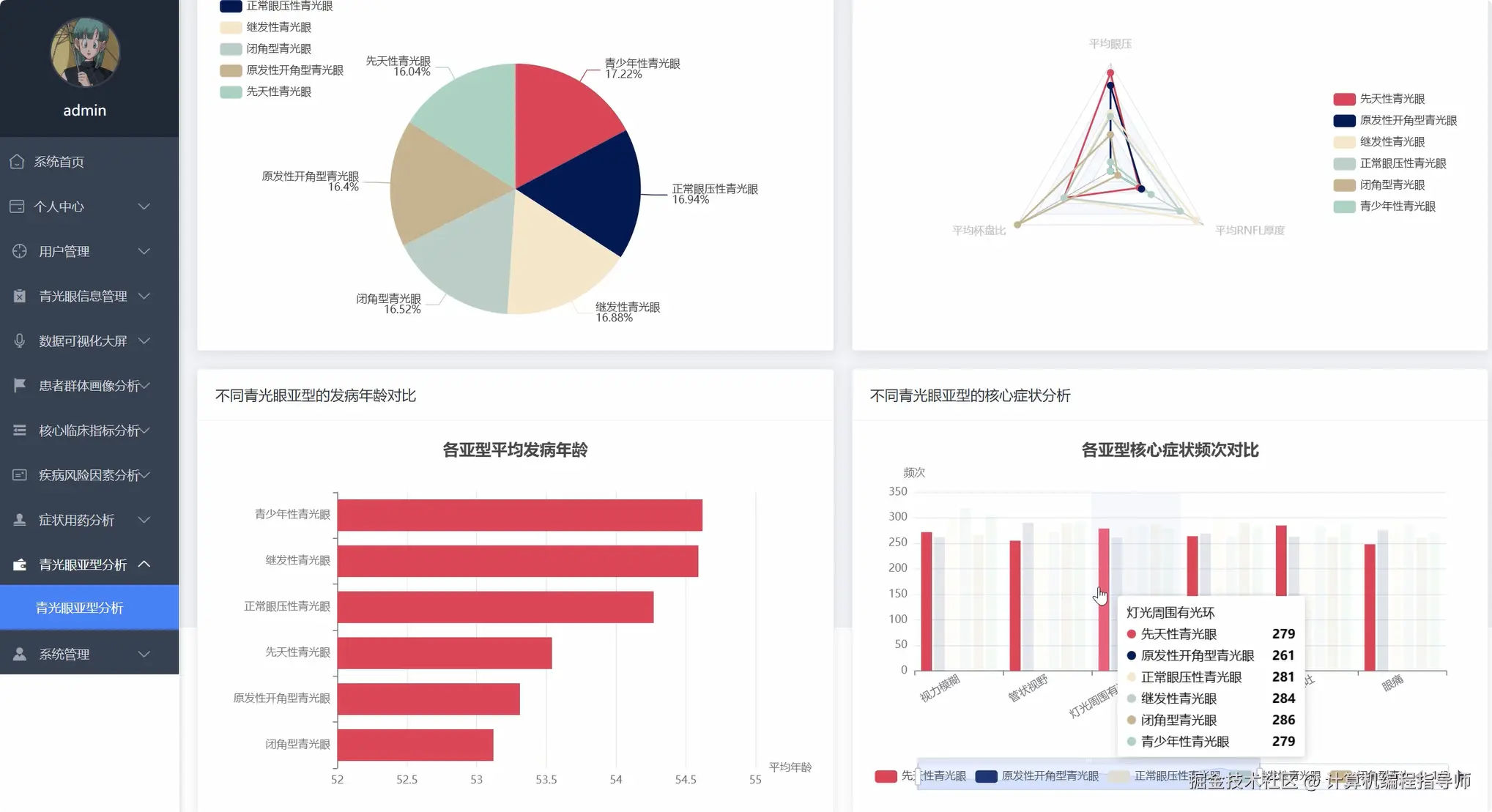青光眼亚型分析.png