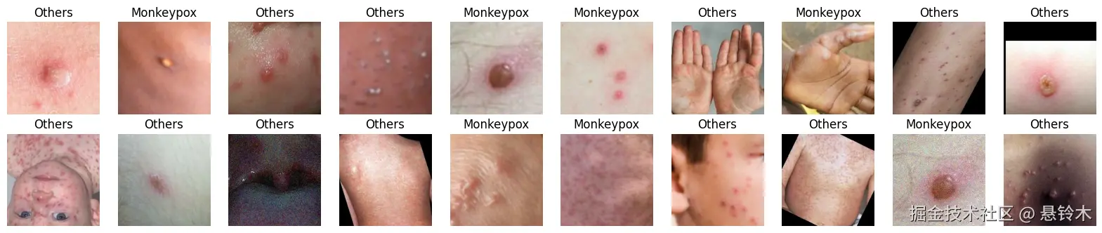 t4_monkeypox_12_1.png