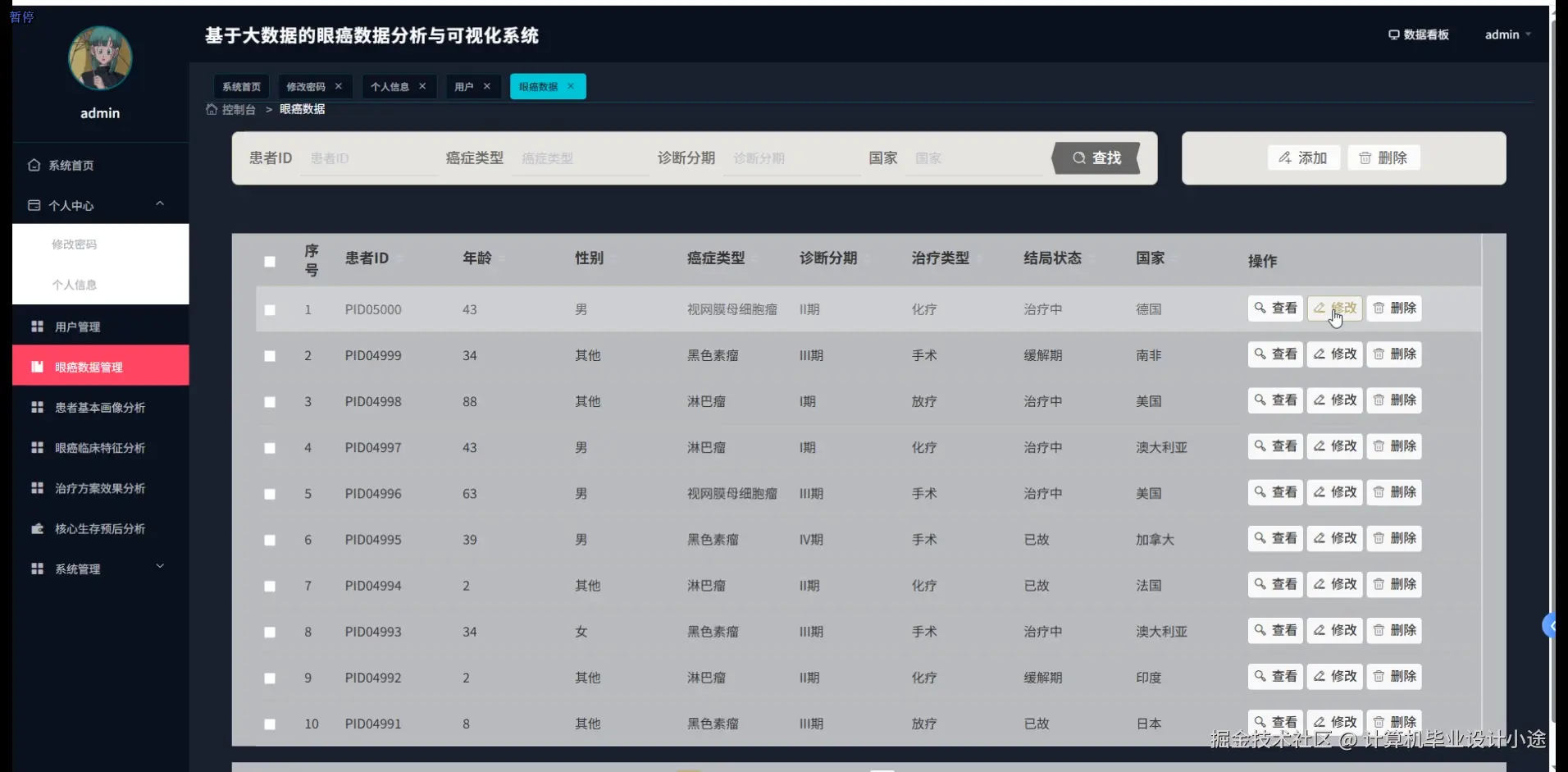 眼癌数据管理.png