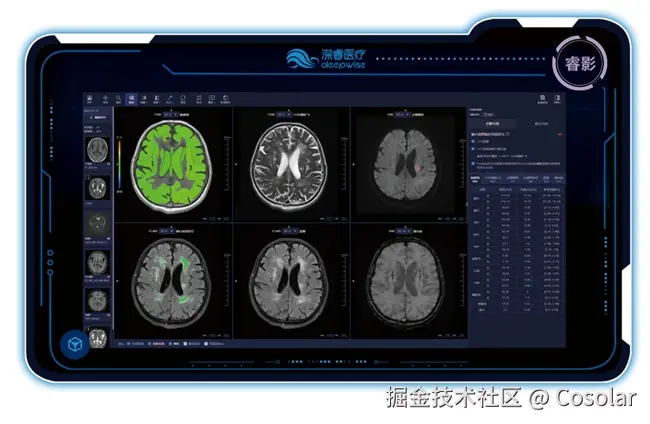 医疗多模态诊断系统界面