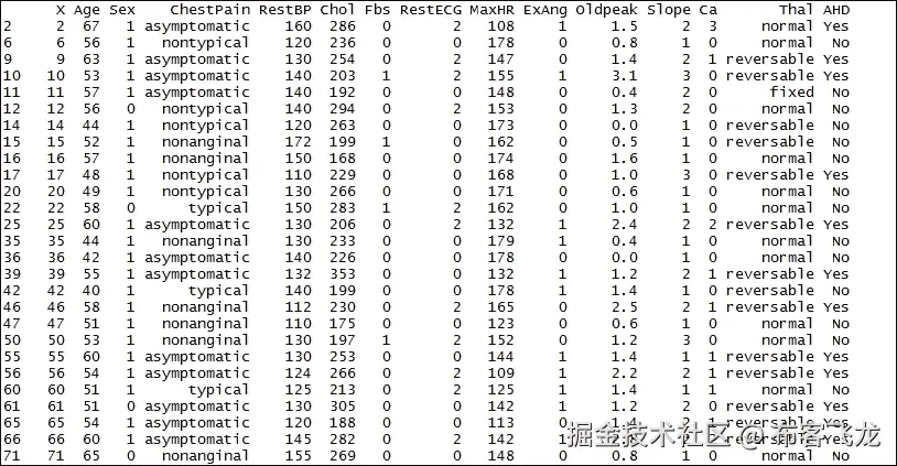 步骤 3 - 准备数据